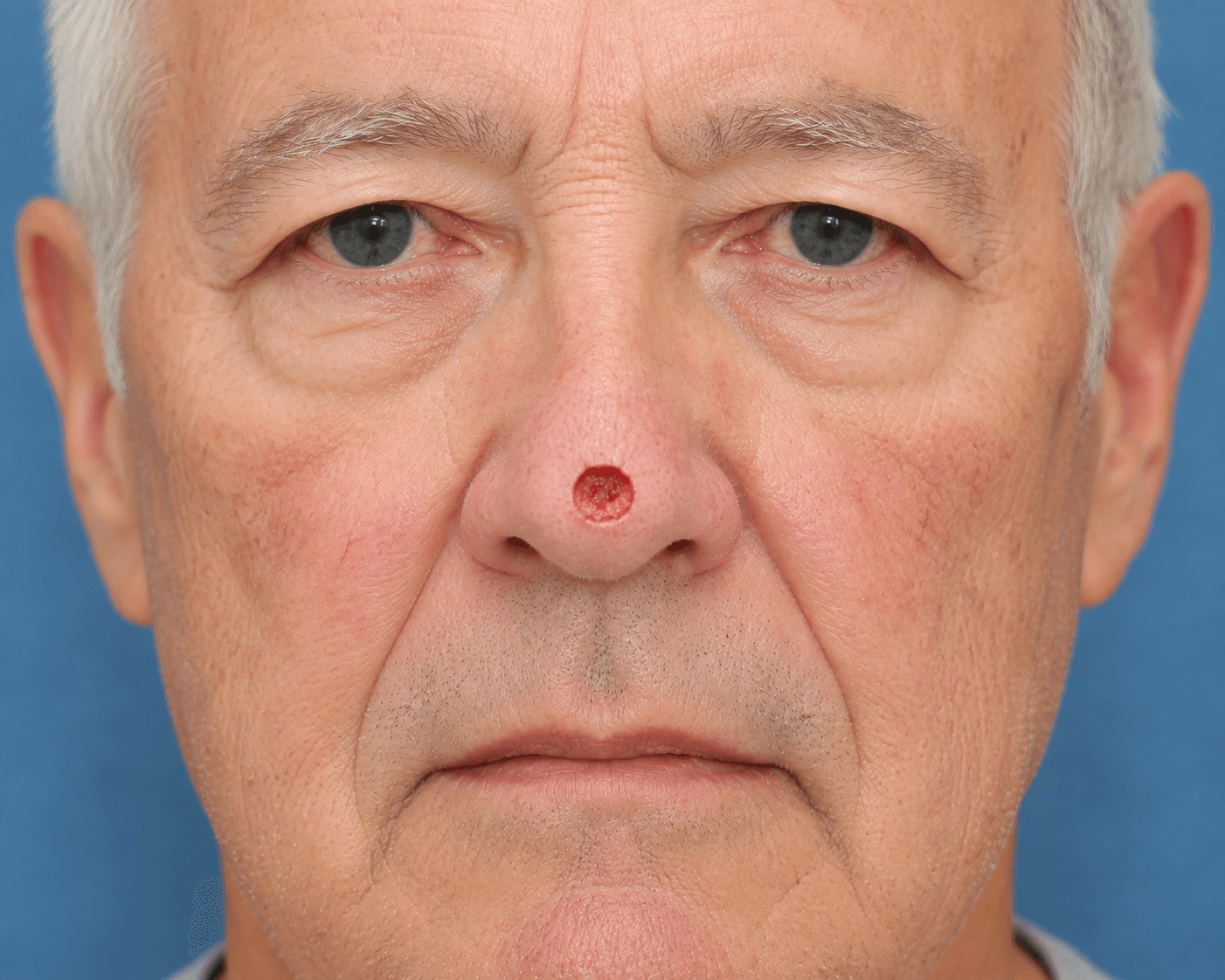 Clinical image for nasal_001
